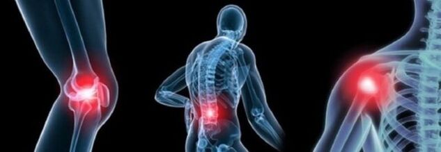 Tipi di dolore con osteoartrosi
