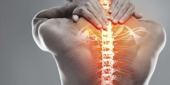 Opzioni mediche per la terapia in cervice dell'osteocondosi cervicale