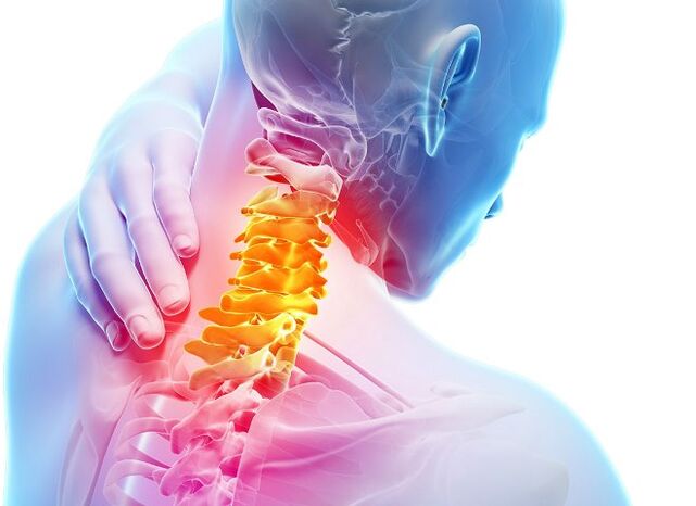 Sintomi e fasi dello sviluppo dell'osteocondosi cervicale