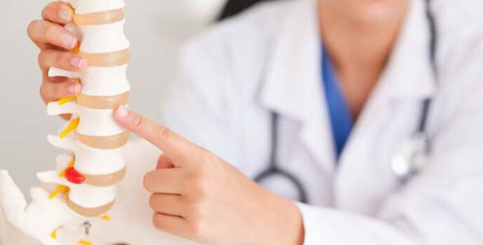 L'osteocondrosi è una malattia spinale