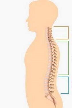 Lesione dell'osteocondosi di diverse parti della colonna vertebrale