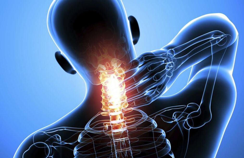 Osteocondrosi del rachide cervicale